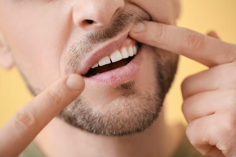 Blasen am Zahnfleisch Ursachen, Symptome & Behandlung